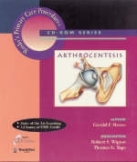 Arthrocentesis