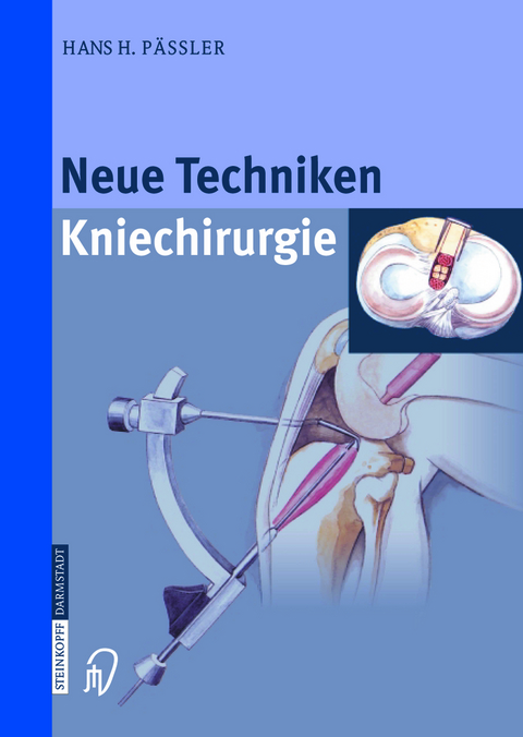 Neue Techniken Kniechirurgie - H.H. P&auml;ssler