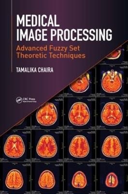 Medical Image Processing - Tamalika Chaira