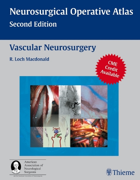 Vascular Neurosurgery - 