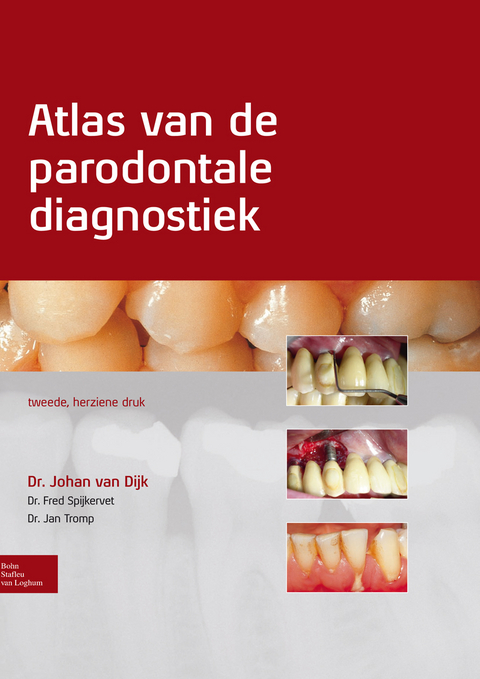 Atlas van de parodontale diagnostiek - Johan Van Dijk, Fred Spijkervet, Jan Tromp