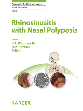 Rhinosinusitis with Nasal Polyposis