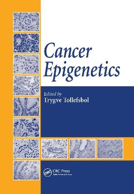 Cancer Epigenetics - 