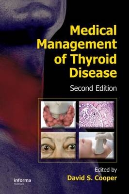 Medical Management of Thyroid Disease