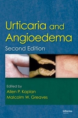 Urticaria and Angioedema - 