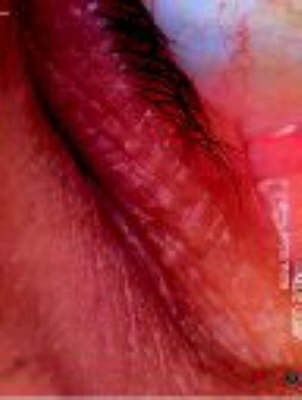 Incarnate - Marc Quinn