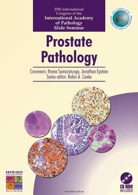 Prostate Pathology