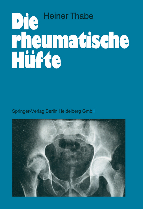 Die rheumatische H&uuml;fte - Heiner Thabe