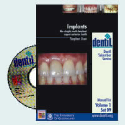 Implants - Stephen Chen