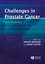 Challenges in Prostate Cancer - 