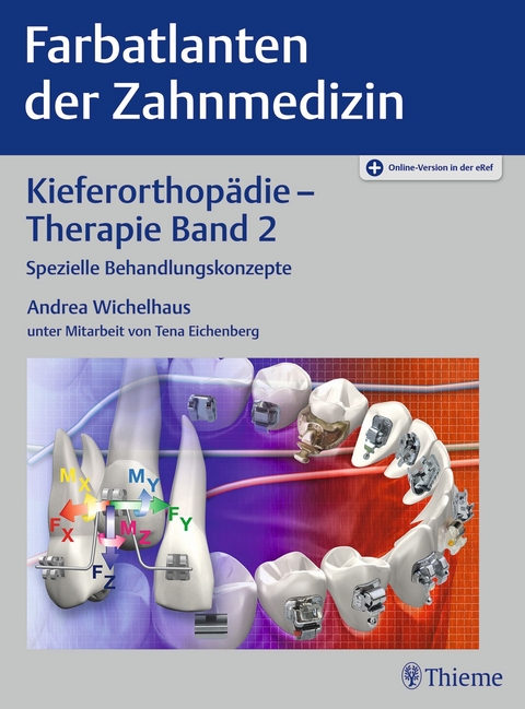 Kieferorthopädie - Therapie Band 2 - Andrea Wichelhaus
