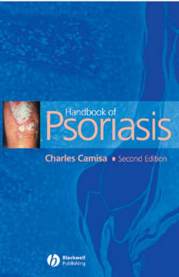 Handbook of Psoriasis - Charles Camisa