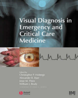 Visual Diagnosis in Emergency and Critical Care Medicine - 