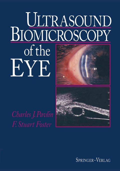 Ultrasound Biomicroscopy of the Eye - Charles J. Pavlin, F.Stuart Foster