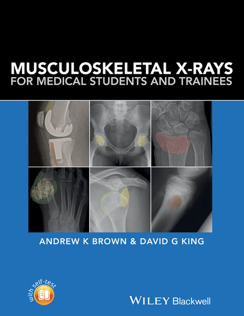Musculoskeletal X-Rays for Medical Students and Trainees - Andrew K. Brown, David G. King