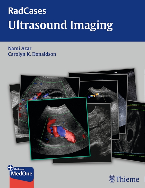 Radcases Ultrasound Imaging - Nami R. Azar, Carolyn Donaldson