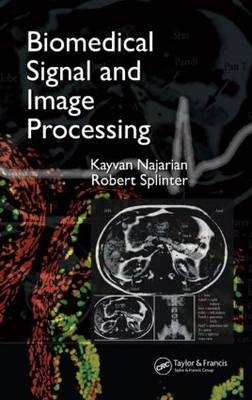 Biomedical Signal and Image Processing - Kayvan Najarian, Robert Splinter