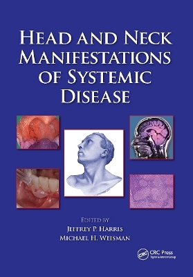 Head and Neck Manifestations of Systemic Disease - 