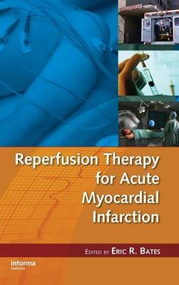 Reperfusion Therapy for Acute Myocardial Infarction - 