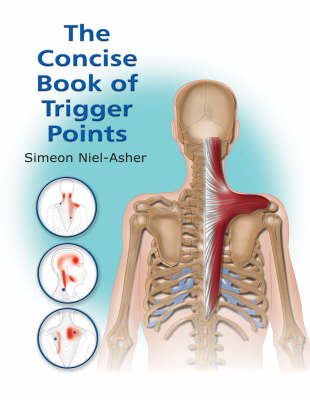 The Concise Book of Trigger Points - Simeon Neil-Asher