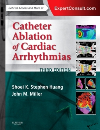 Catheter Ablation of Cardiac Arrhythmias