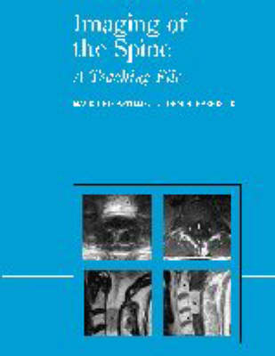Imaging of the Spine - Mauricio Castillo, John H. Harris Jr