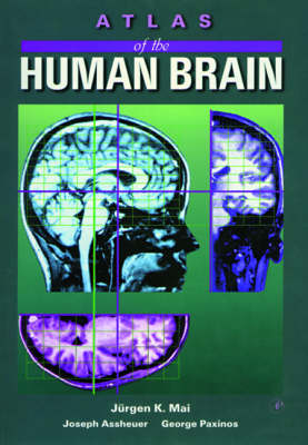 Atlas of the Human Brain - Juergen K. Mai, Joseph K. Assheuer, George Paxinos