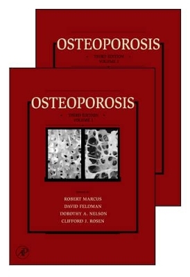 Osteoporosis - 