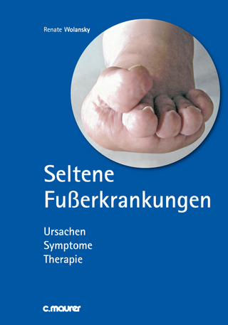 Seltene Fußerkrankungen