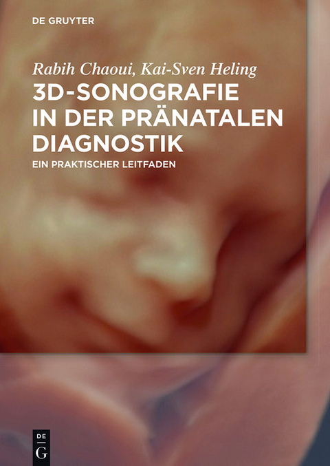 3D-Sonografie in der pr&auml;natalen Diagnostik - Rabih Chaoui, Kai-Sven Heling