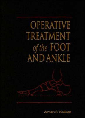 Operative Treatment of the Foot and Ankle