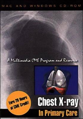 Chest X-Ray Interpretation In Primary Care