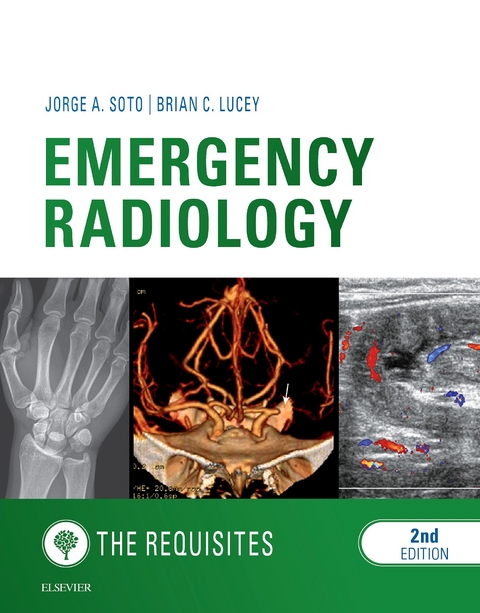 Emergency Radiology: The Requisites E-Book -  Brian C Lucey,  Jorge A Soto