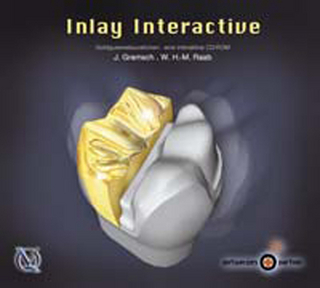 Inlay Interactive