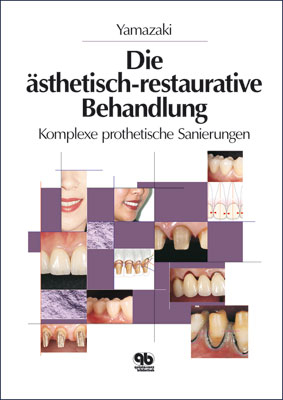 &Auml;sthetisch-restaurative Behandlung - Masao Yamazaki