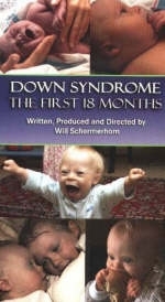 Down Syndrome