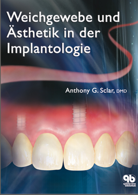 Weichegewebe und &Auml;sthetik in der Implantologie - Anthony G. Sclar