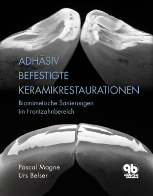 Adh&auml;siv befestigte Keramikrestaurationen im Frontzahnbereich - Urs C. Belser, Pascal Magne