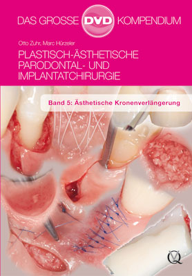 Plastisch-Ästhetische Parodontal- und Implantatchirurgie