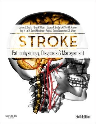 Stroke - James C. Grotta, Gregory W. Albers, Joseph P. Broderick, Scott Eric Kasner