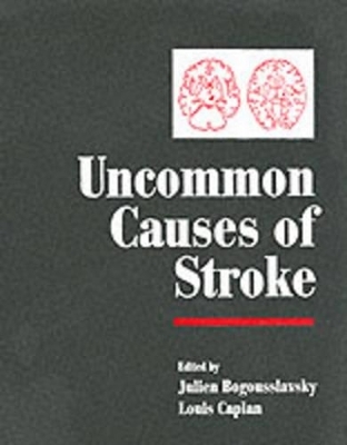Stroke Syndromes (Second Edition) and Uncommon Causes of Stroke 2 Volume Hardback Set