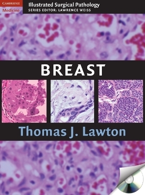 Breast