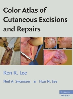 Color Atlas of Cutaneous Excisions and Repairs - Ken K. Lee, Neil A. Swanson, Han N. Lee