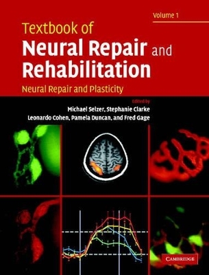 Textbook of Neural Repair and Rehabilitation 2 Volume Hardback Set