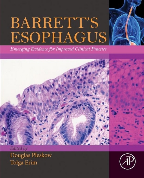 Barrett's Esophagus -  Tolga Erim,  Douglas Pleskow