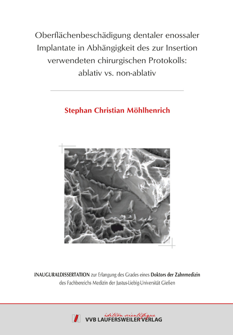 Oberfl&auml;chenbesch&auml;digung dentaler enossaler Implantate in Abh&auml;ngigkeit des zur Insertion verwendeten chirurgischen Protokolls: ablativ vs. non-ablativ - Stephan Christian M&ouml;hlhenrich