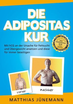 Die Adipositas-Kur - Matthias J&uuml;nemann