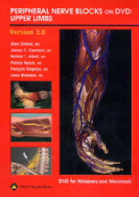 Peripheral Nerve Blocks on DVD: Upper Limbs