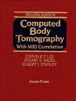 Computed Body Tomography with MRI Correlation