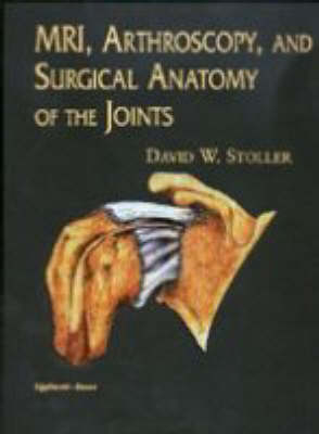 MRI Arthroscopy and Surgical Anatomy of the Joints